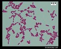 Escherichia coli Gram-stain